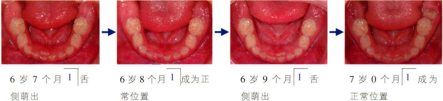 ②7~8歲的學齡期